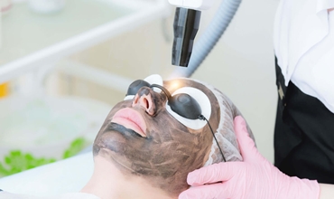 Best Carbon Laser Facial Clinic in Greater Noida