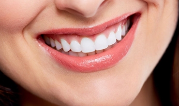 Best Smile Makeover Clinic in Greater Noida